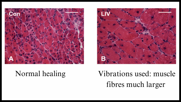 Muscle fibres healing with vibration